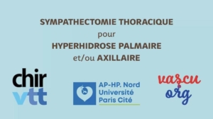 Hyperhidrose_palmaire_sympathectomie_thoracique_chirvtt-Hopital_Bichat